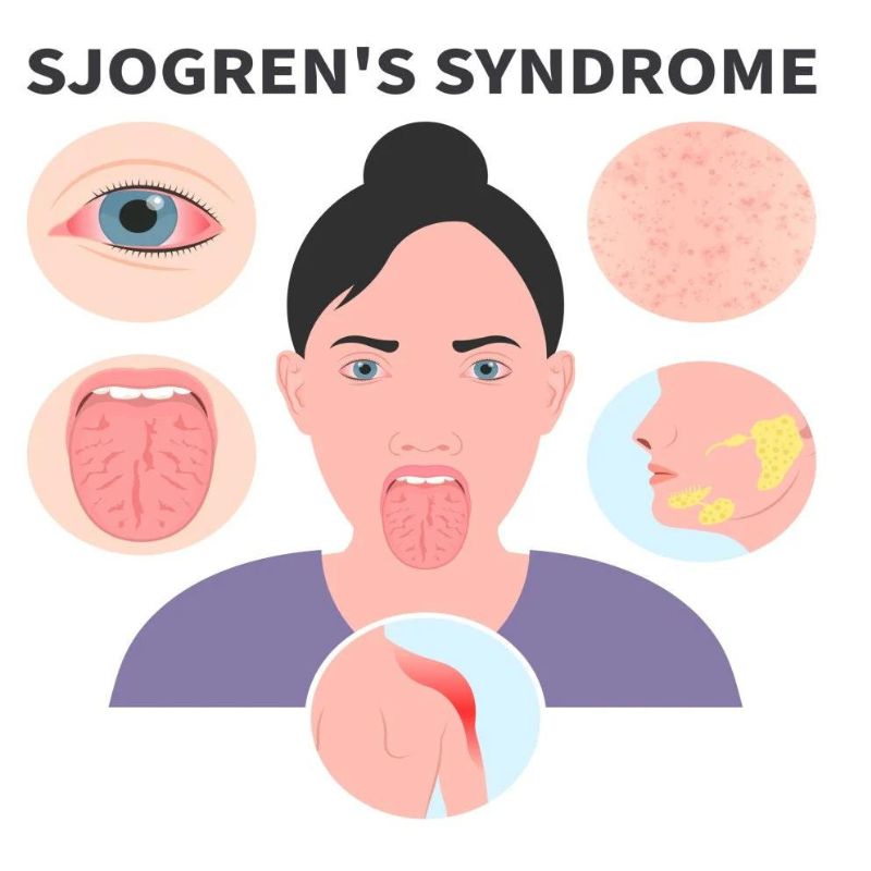 Hoi-chung-Sjogren Hoi-chung-Sjogren
