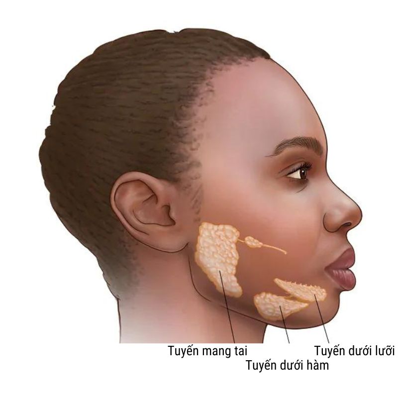 Tuyen-nuoc-bot