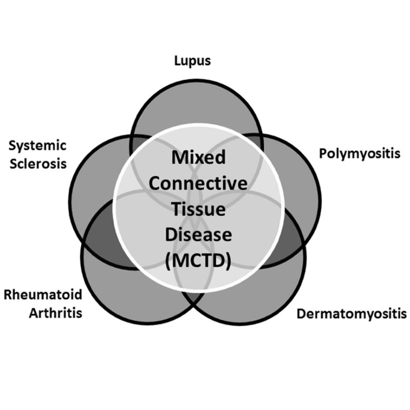 MCTD
