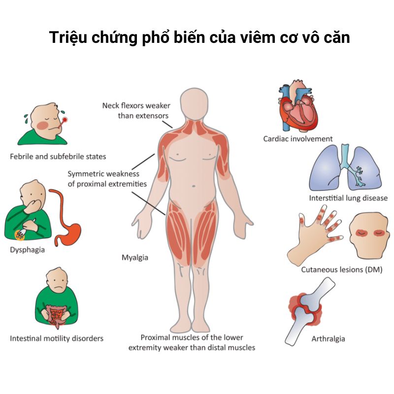 Viem-co-vo-can-IIM (2)