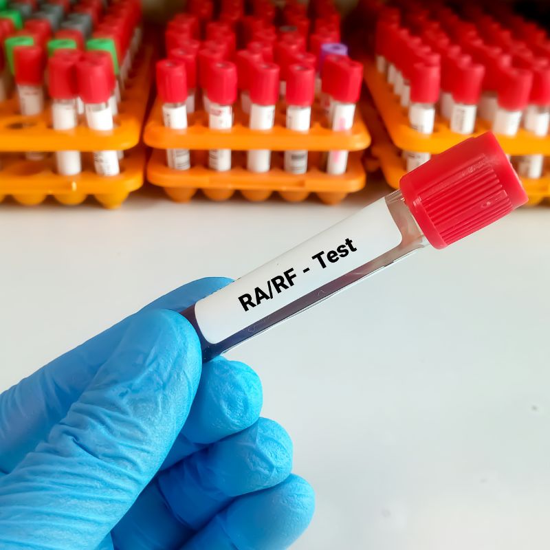 Xet-nghiem-RF