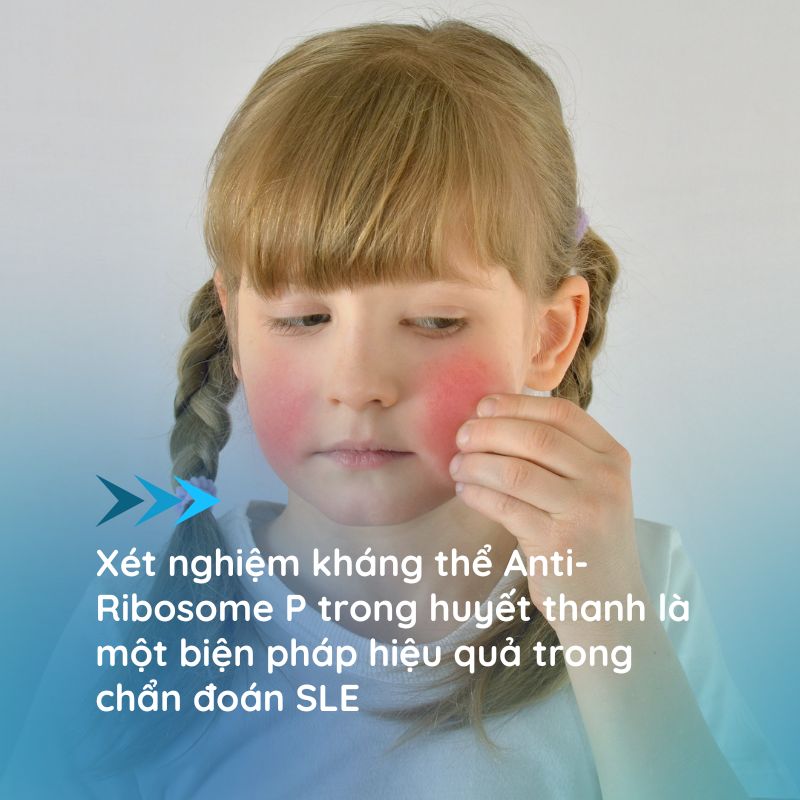 Anti-Ribosome-P Anti-Ribosome-P
