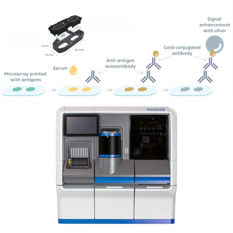 So sánh ELISA microarray đa kênh và ELISA cổ điển - Benhtumien