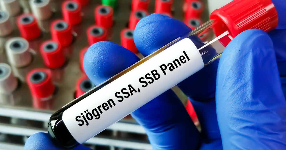 Hoi-chung-Sjogren Hoi-chung-Sjogren