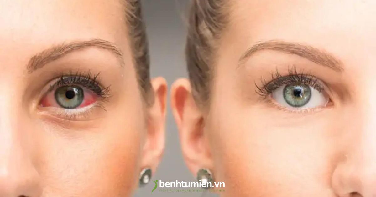 Hoi-chung-Sjogren Hoi-chung-Sjogren