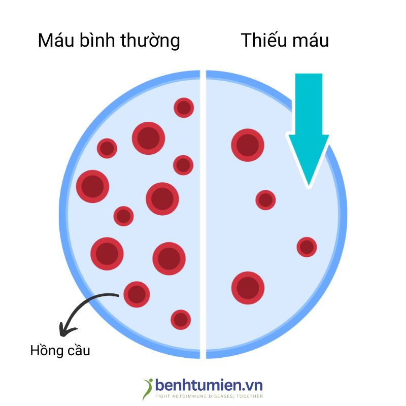 Thieu-mau