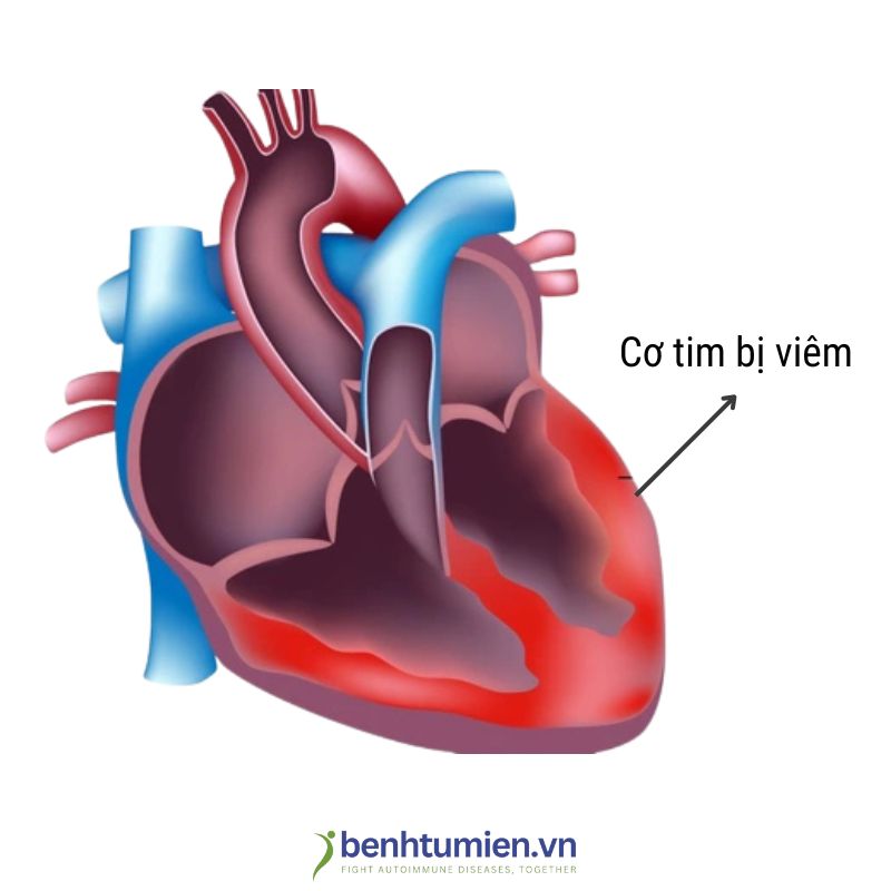 Viem-co-tim
