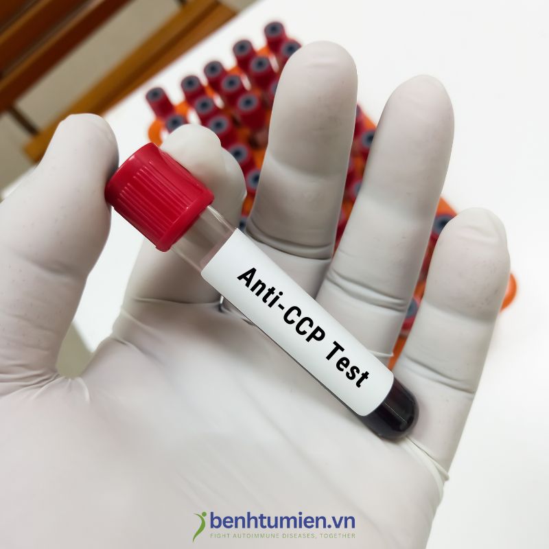 Anti-CCP-test