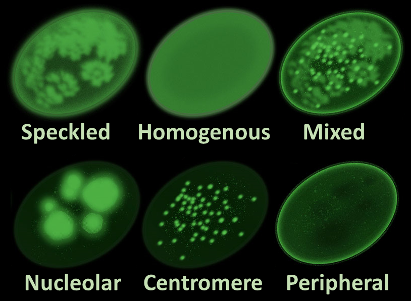 Main_antinuclear_antibody_patterns_on_immunofluorescence-1