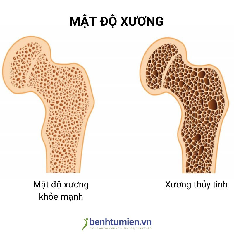 xuong-thuy-tinh xuong-thuy-tinh