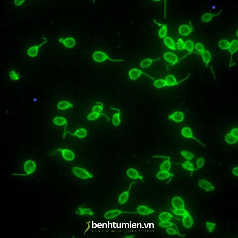 Te-bao-Crithidia-luciliae