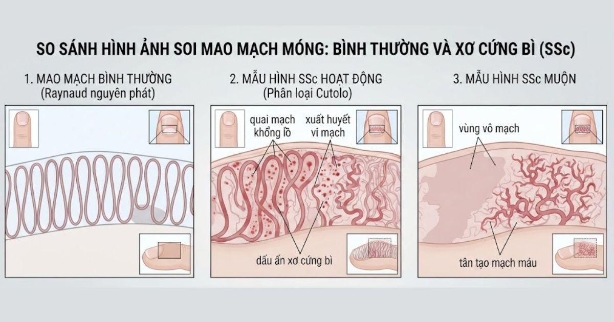 Hinh-anh-soi-mao-mach-mong